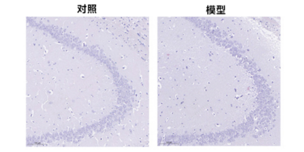 阿尔兹海默症模型（小鼠）