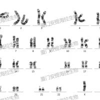 染色体核型鉴定