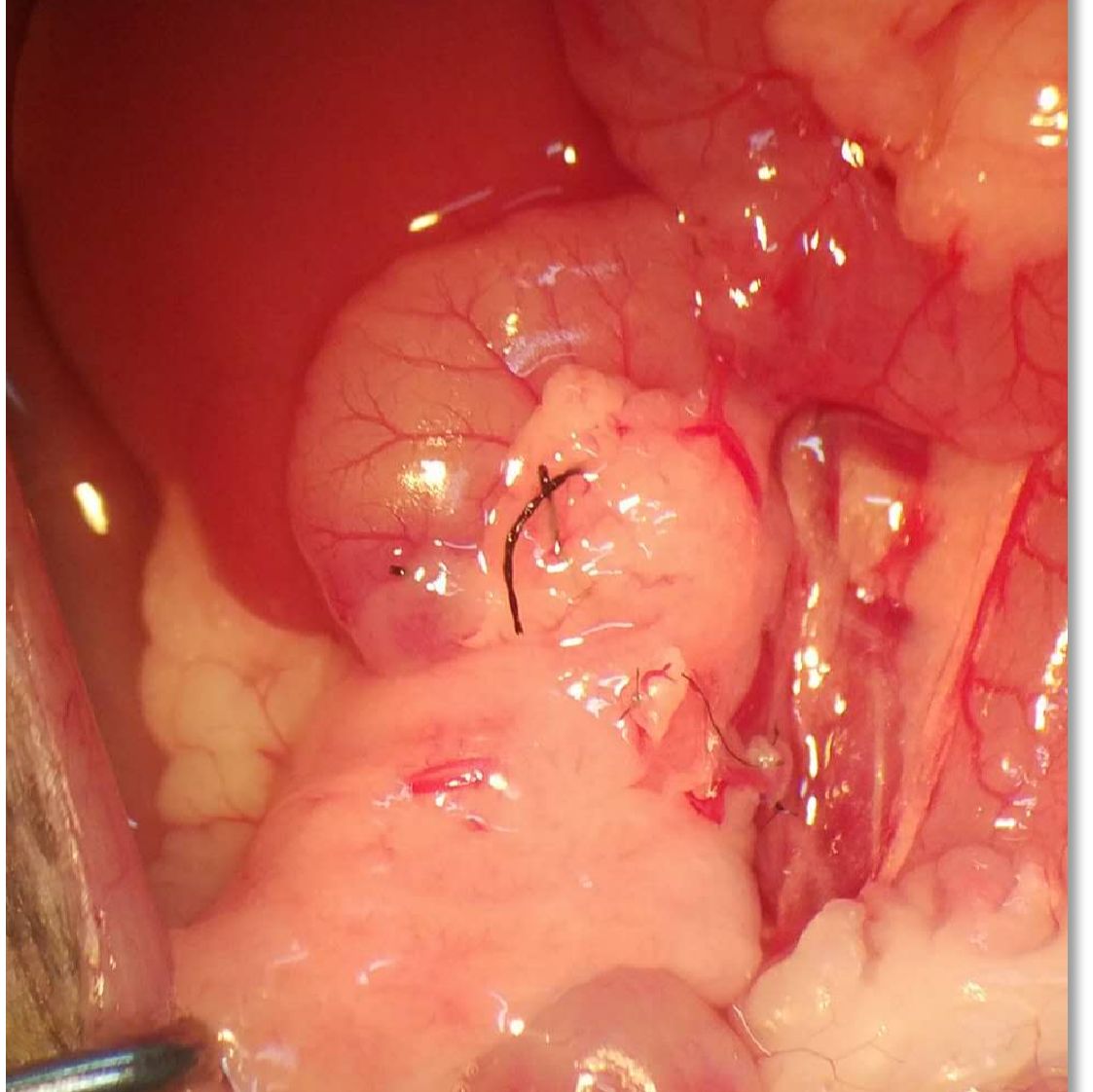 大小鼠胰腺移植模型