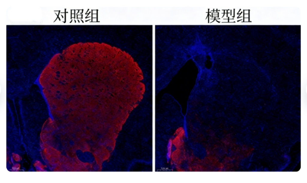 大鼠帕金森模型（6-OHDA诱导）