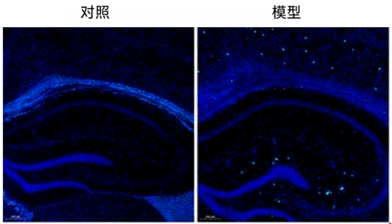 阿尔兹海默症模型（小鼠）
