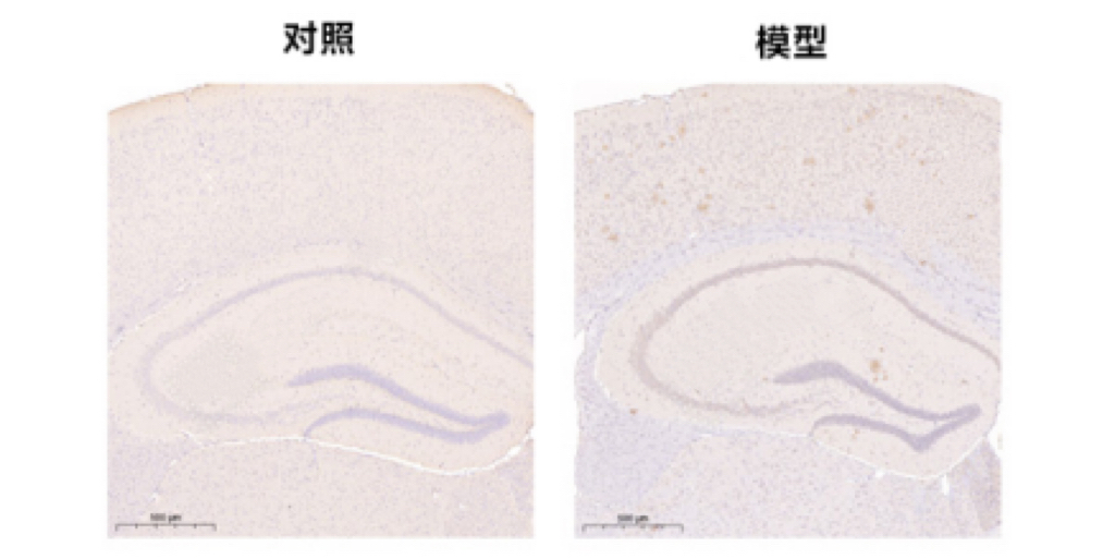 阿尔兹海默症模型（小鼠）