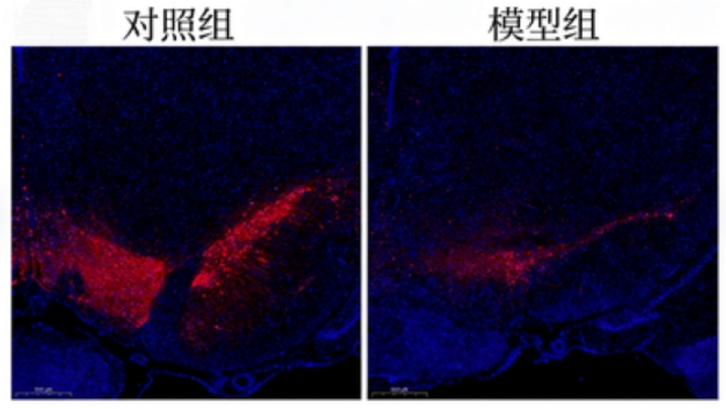 大鼠帕金森模型（6-OHDA诱导）