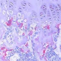 ALP 碱性磷酸酶染色