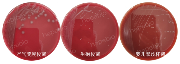 CDC厌氧菌琼脂原理和使用方法