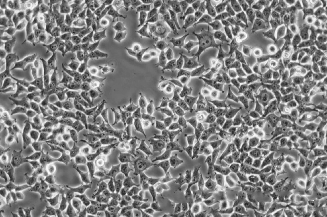 盘点七大常见的细胞模型，你知道过表达选择什么模型吗?