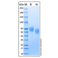 Recombinant human BACE1 protein，ActiBioPure™, Bioactive, Animal Free, Carrier Free, Azide Free, ≥90%(SDS-PAGE)，阿拉丁