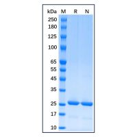 Recombinant Human Bcl-2 Protein，Carrier Free, Azide Free, ≥90%(SDS-PAGE)，阿拉丁