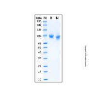 Recombinant Human Integrin alpha 4 Protein，无动物源, Carrier Free, ≥95%(SDS-PAGE)，阿拉丁