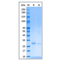 Recombinant Human SDHB Protein，Carrier Free, Azide Free, ≥90%(SDS-PAGE)，阿拉丁