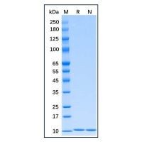 Recombinant Human HA-Ubiquitin Protein,无载体, Azide Free, ≥98%(SDS-PAGE),阿拉丁