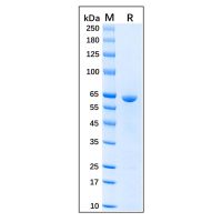 Recombinant Human Hsp60 Protein，Carrier Free, Azide Free, ≥95%(SDS-PAGE)，阿拉丁