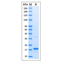 Recombinant Human p21 Protein，Carrier Free, Azide Free, ≥90%(SDS-PAGE)，阿拉丁