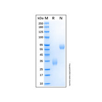 Recombinant Human LOX-1/OLR1 Protein,无动物源, Carrier Free, ≥95%(SDS-PAGE),阿拉丁