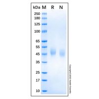 Recombinant Human uPAR Protein,Animal Free, Carrier Free, ≥95%(SDS-PAGE),阿拉丁