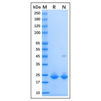 Recombinant Human Cyclophilin B Protein,Carrier Free, Azide Free, ≥95%(SDS-PAGE),阿拉丁