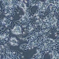 人尤文氏肉瘤细胞；RD-ES(STR)