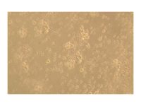 Recombinant Human CD83 Protein,ActiBioPure™, Bioactive, Animal Free, Carrier Free, Azide Free, High performance, ≥90%(SDS-PAGE),阿拉丁