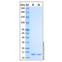 Recombinant Human Profilin 1 Protein，Carrier Free, Azide Free, ≥95%(SDS-PAGE)，阿拉丁
