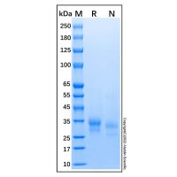 Recombinant Human IL-29/IFN-lambda 1 Protein,阿拉丁
