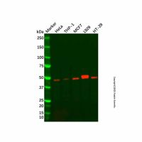 Recombinant Vitamin D Receptor Antibody，ExactAb™, Validated, 重组, 1.5 mg/mL，阿拉丁