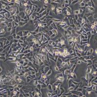 人鼻咽癌细胞；CNE(STR hela交叉污染)