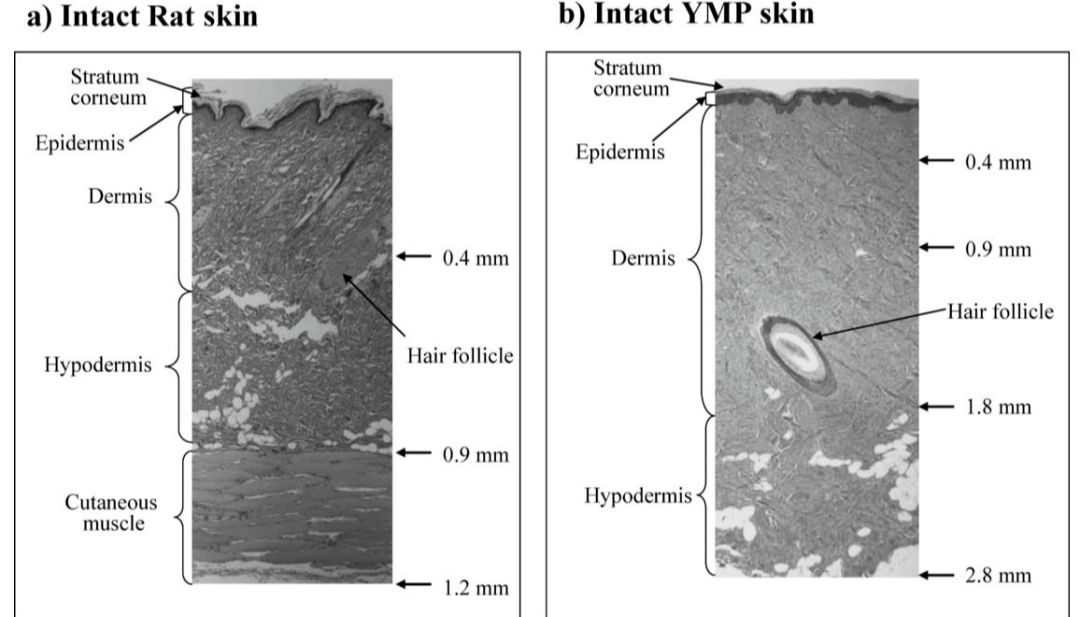 文献分享 | 离体皮肤厚度如何影响药物透皮吸收