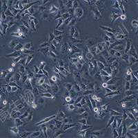 人鼻咽癌细胞；CNE2(STR hela交叉污染)