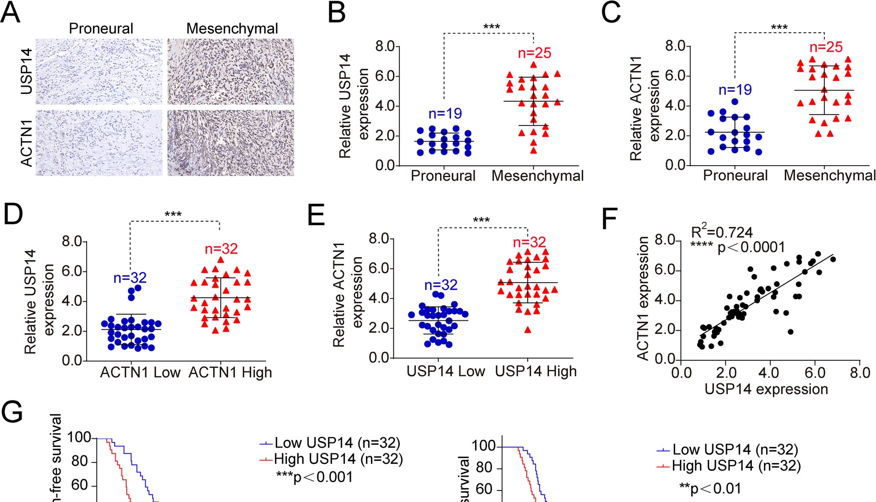 去泛素化专题|Communications Biology（Nature 子刊）解读：USP14介导的ACTN1稳定维持胶质母细胞瘤间质特性
