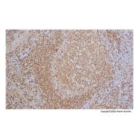 Recombinant HLA-DR Antibody,ExactAb™, Validated, Recombinant, 0.12 mg/mL,阿拉丁