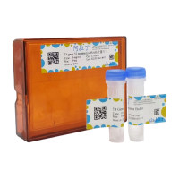 T4 Gene 32 Protein (ssDNA结合蛋白)，不含DNA内切酶和外切酶，不含核糖核酸酶及磷酸酶。，阿拉丁