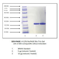 C-反应蛋白,人血浆,≥95%(SDS-PAGE), Extinction Coefficient: 1.75,阿拉丁