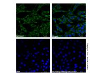 MMP2 Mouse mAb，ExactAb™, Validated, Carrier Free, Lot by Lot，阿拉丁