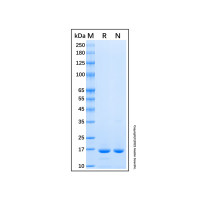 Recombinant Human UbcH7/UBE2L3 Protein,Carrier Free, ≥95%(SDS-PAGE), Lot by Lot,阿拉丁