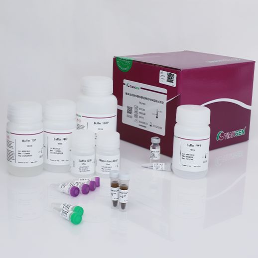 天根 磁珠法高效多糖多酚植物总RNA提取试剂盒(DP772)