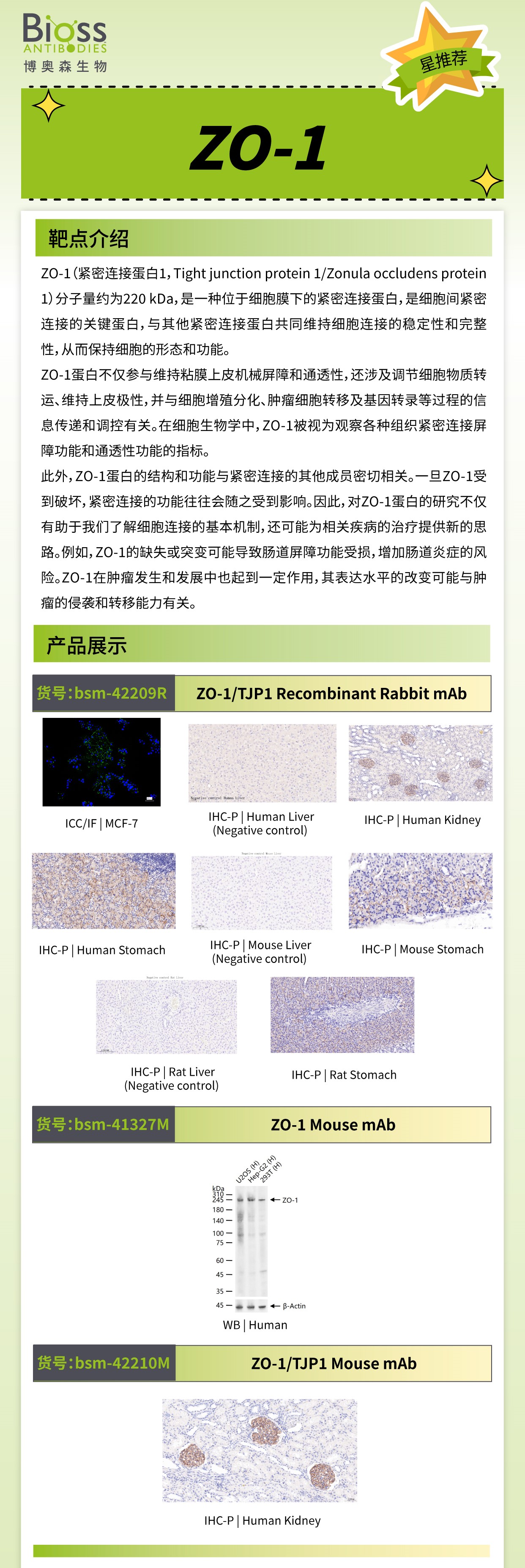 博奥森星推荐 | ZO-1 抗体
