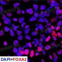 hPSC诱导运动神经元祖细胞