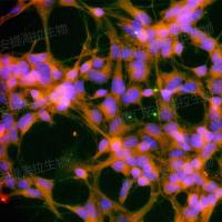 hPSC诱导中脑多巴胺神经元细胞