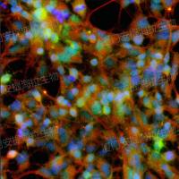 hPSC诱导运动神经元细胞