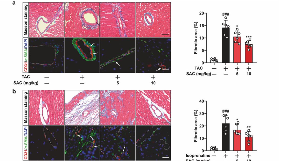 实验“神队友”BSA：百搭应用，隐形的实力派