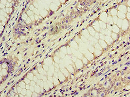 CSB-PA854112ESR1HU IHC-1