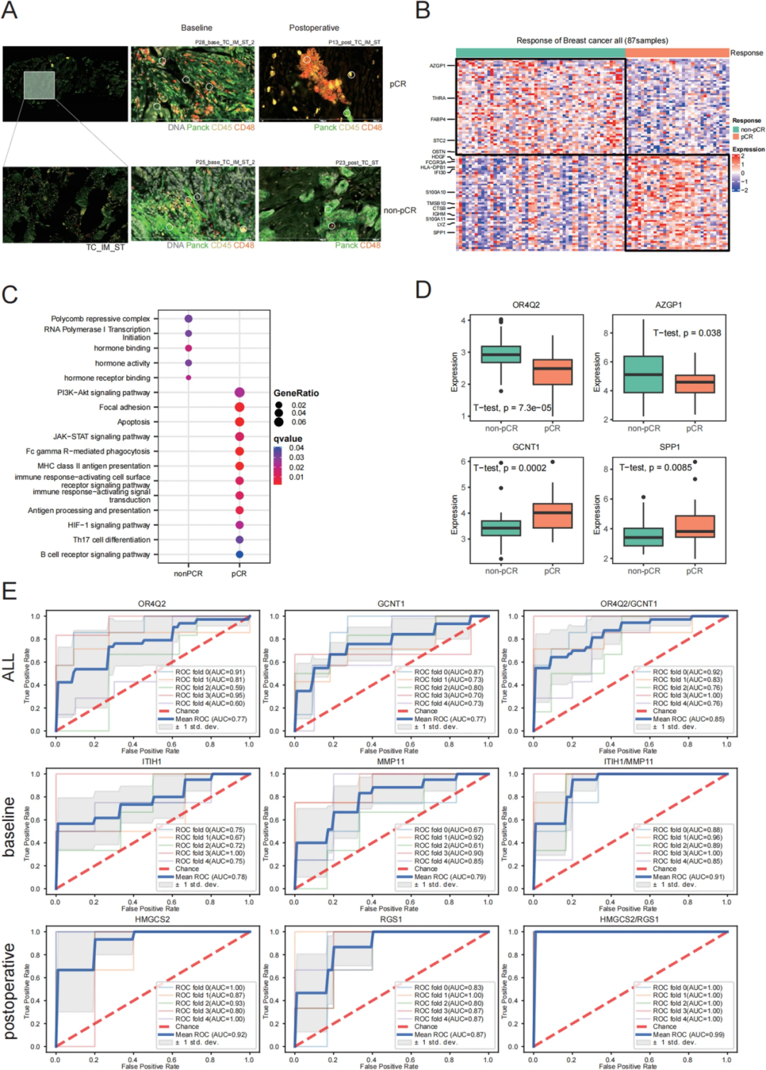 芯空一号快讯｜空间转录组助力揭示HER2⁺乳腺癌新辅助治疗疗效的免疫演化轨迹