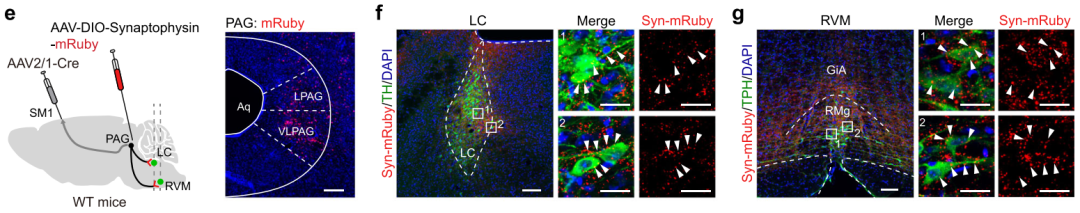 【新手指南】小白速看｜突触囊泡膜蛋白Synaptophysin——神经元标记及突触前定位工具