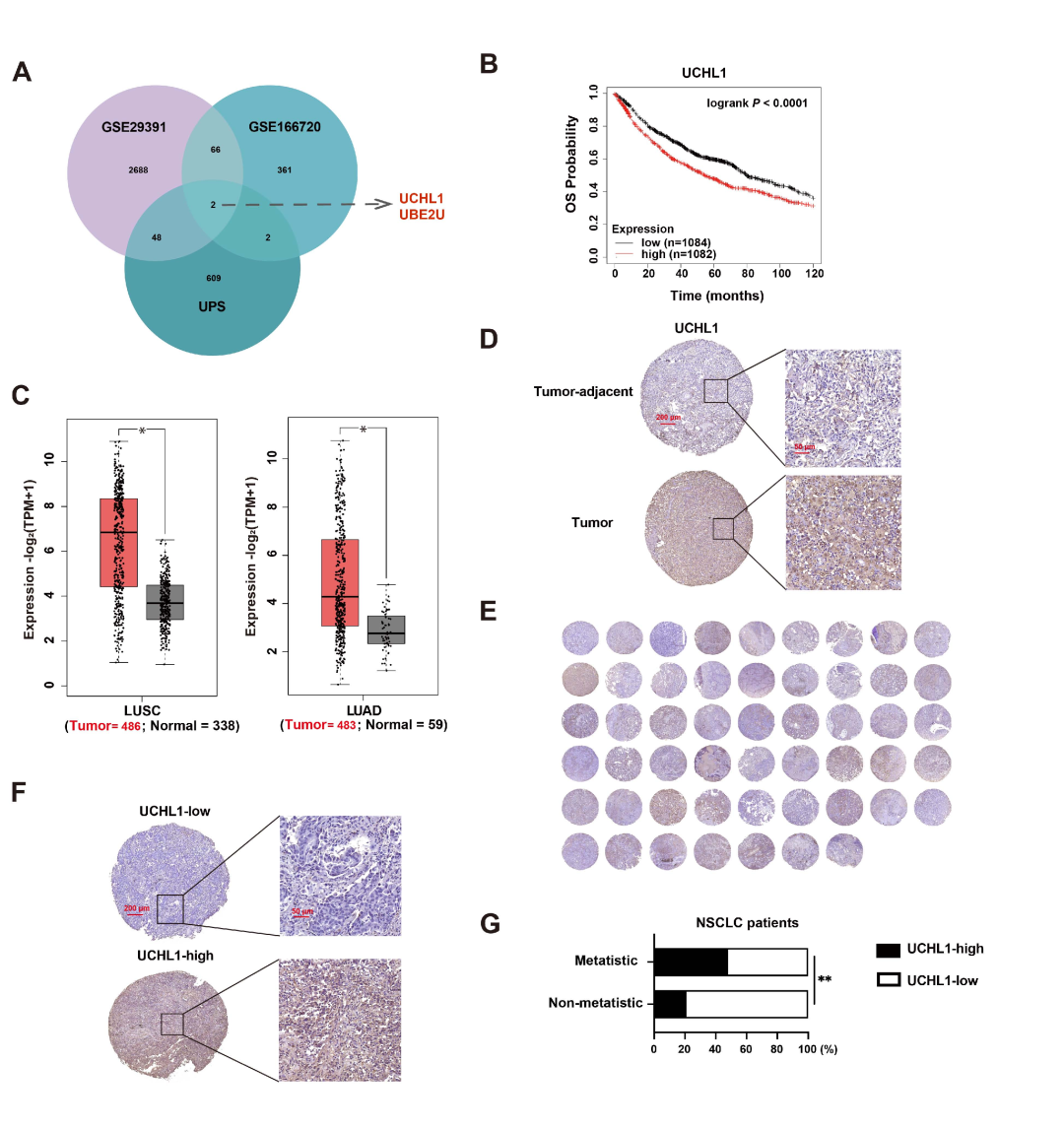 去泛素化专题|《Cell Death Discovery》（2024IF：9.5998，JCR Q1）解读：UCHL1 通过去泛素化稳定 Twist1 驱动 NSCLC 转移