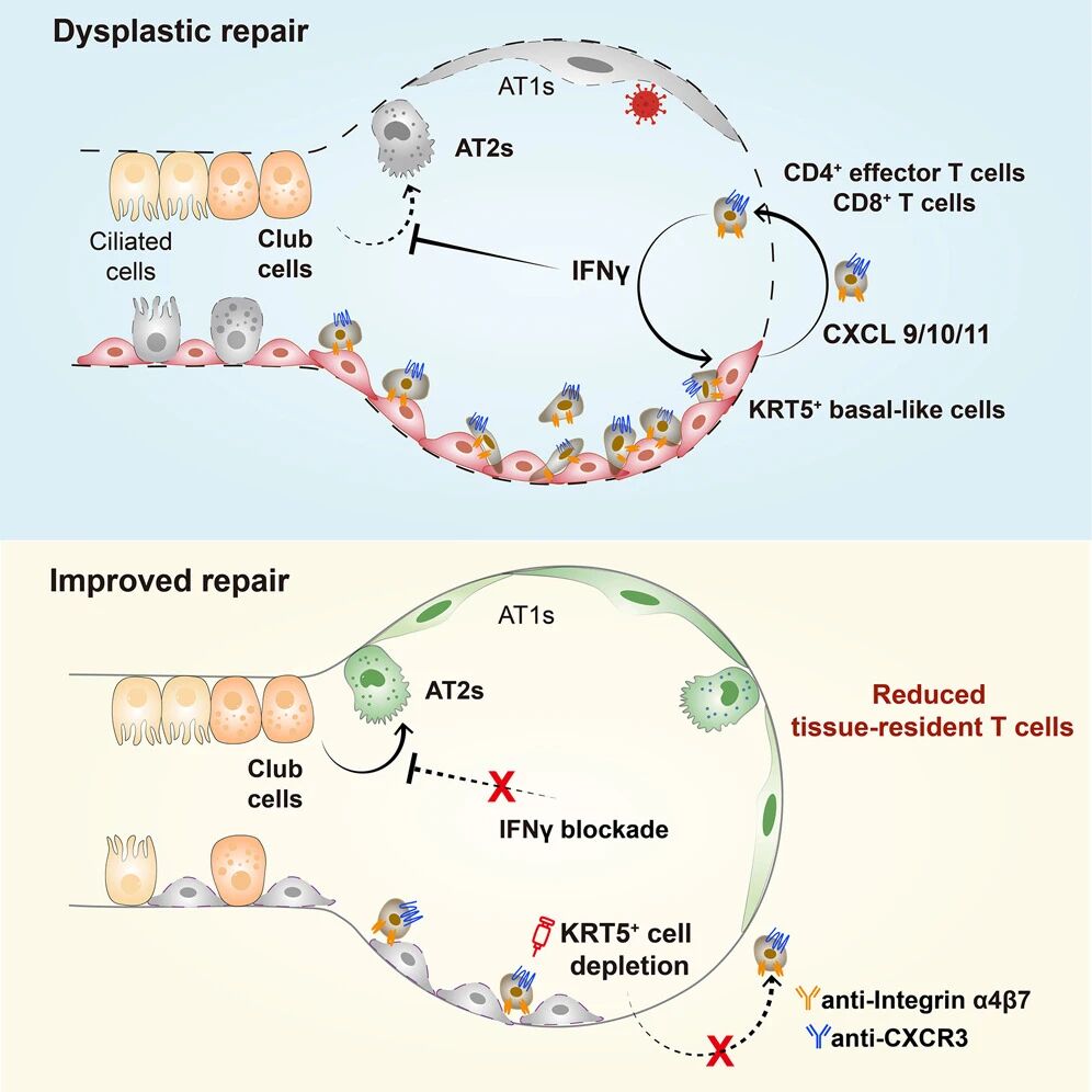 双重突破 双重突破