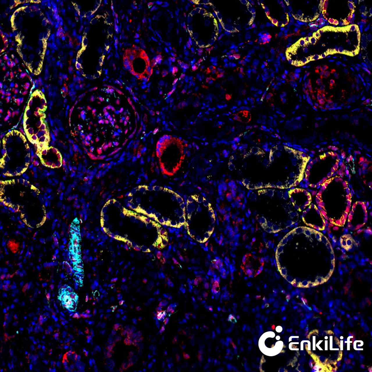TSA五标六色多重荧光染色试剂盒(mIHC)