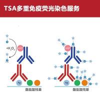 TSA多重免疫荧光染色技术服务