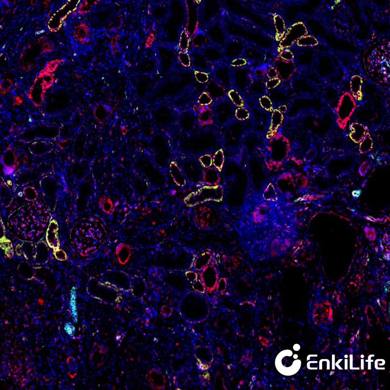 TSA三标四色多重荧光染色试剂盒（mIHC）