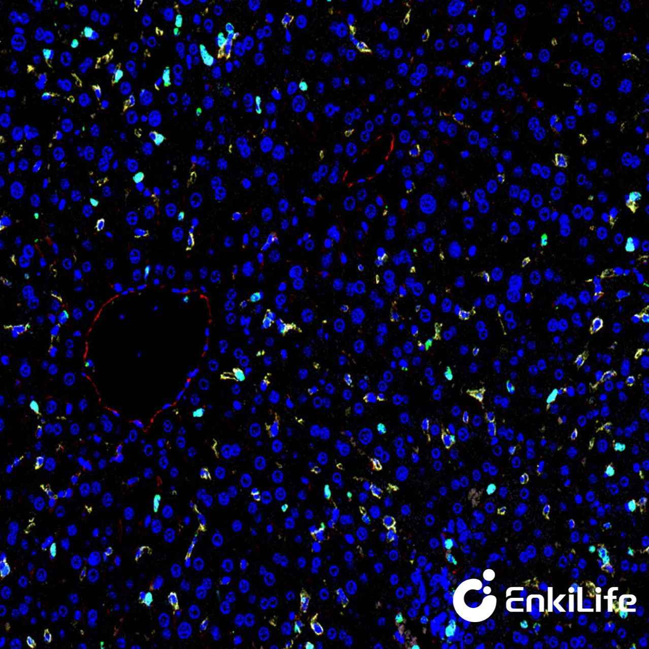 TSA四标五色多重荧光染色试剂盒(mIHC)