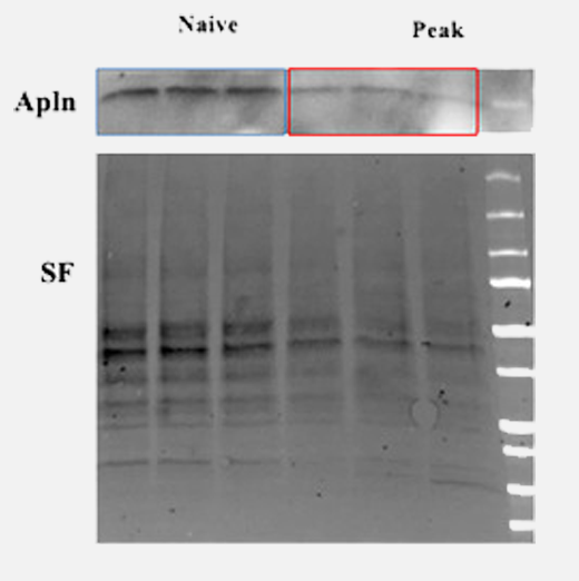 多发性硬化的神经保护